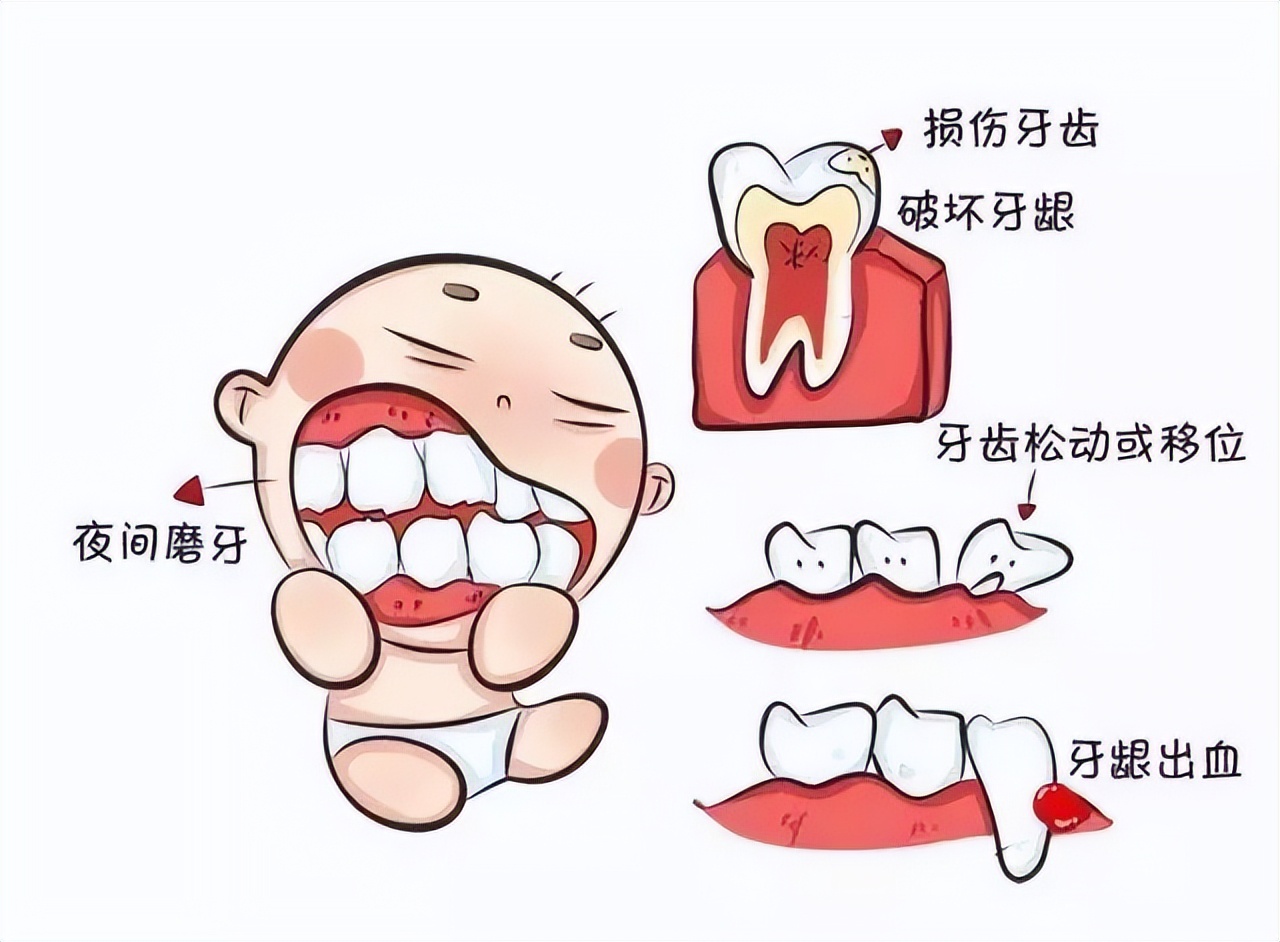 夜间睡觉磨牙是什么毛病,睡觉磨牙是很正常的现象