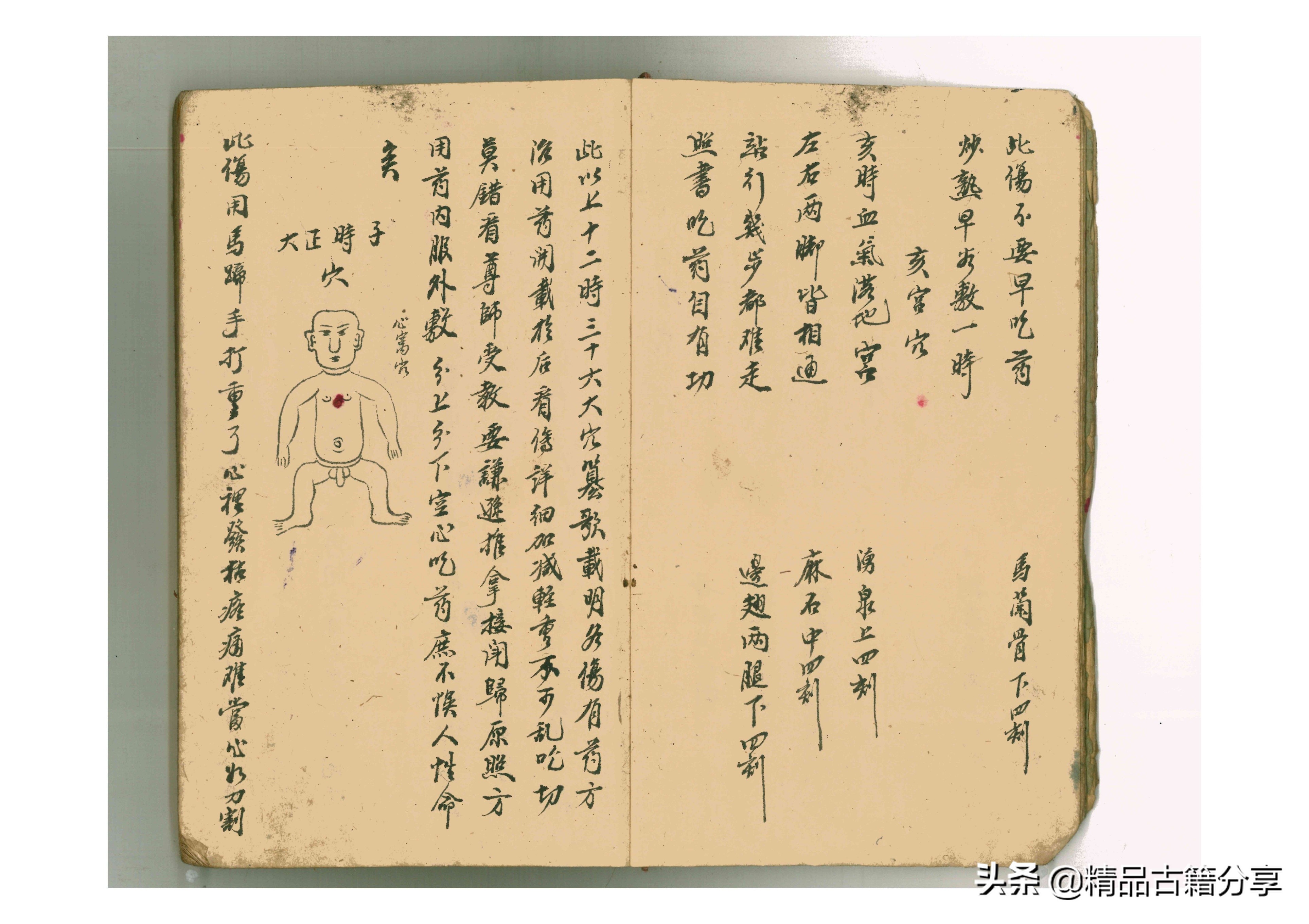 跌打秘方传书,祖传治疗跌打秘方