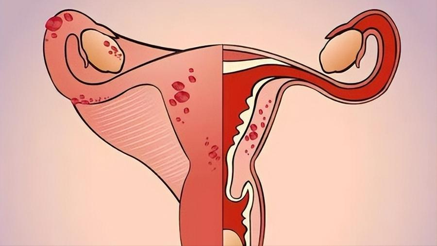 试纸、抽血均显示怀孕，为什么医生却说没怀孕？怀孕还能有假的？