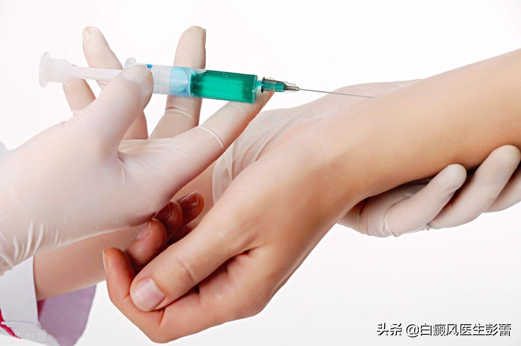 白癜风最佳用药是什么,白癜风药物治疗有哪些