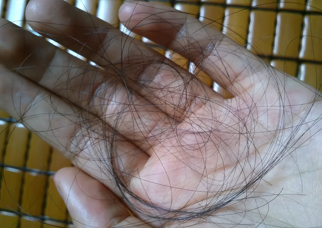 二阳症状不重会有后遗症么,二阳之后会有哪些后遗症