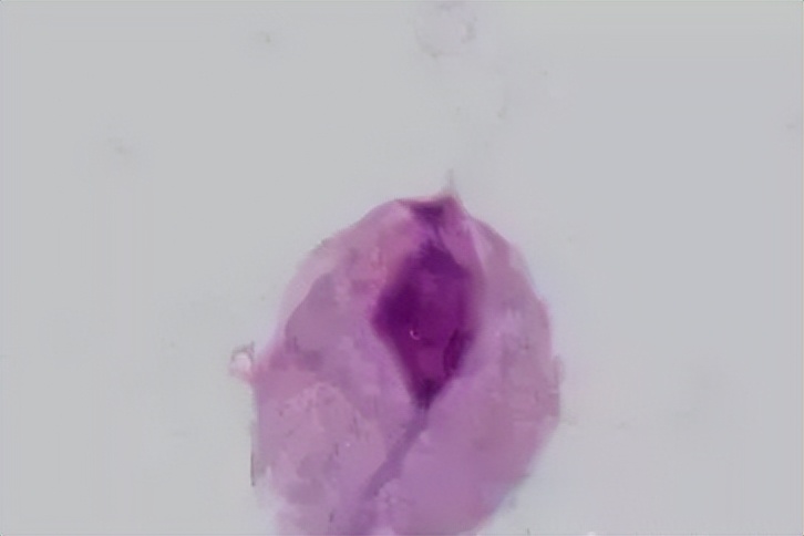 派特灵治妇科病吗,派特灵在妇科怎么使用