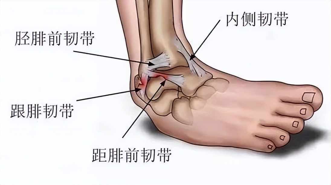 踝关节韧带重建后的最佳锻炼方法,冉冉跟腱康复
