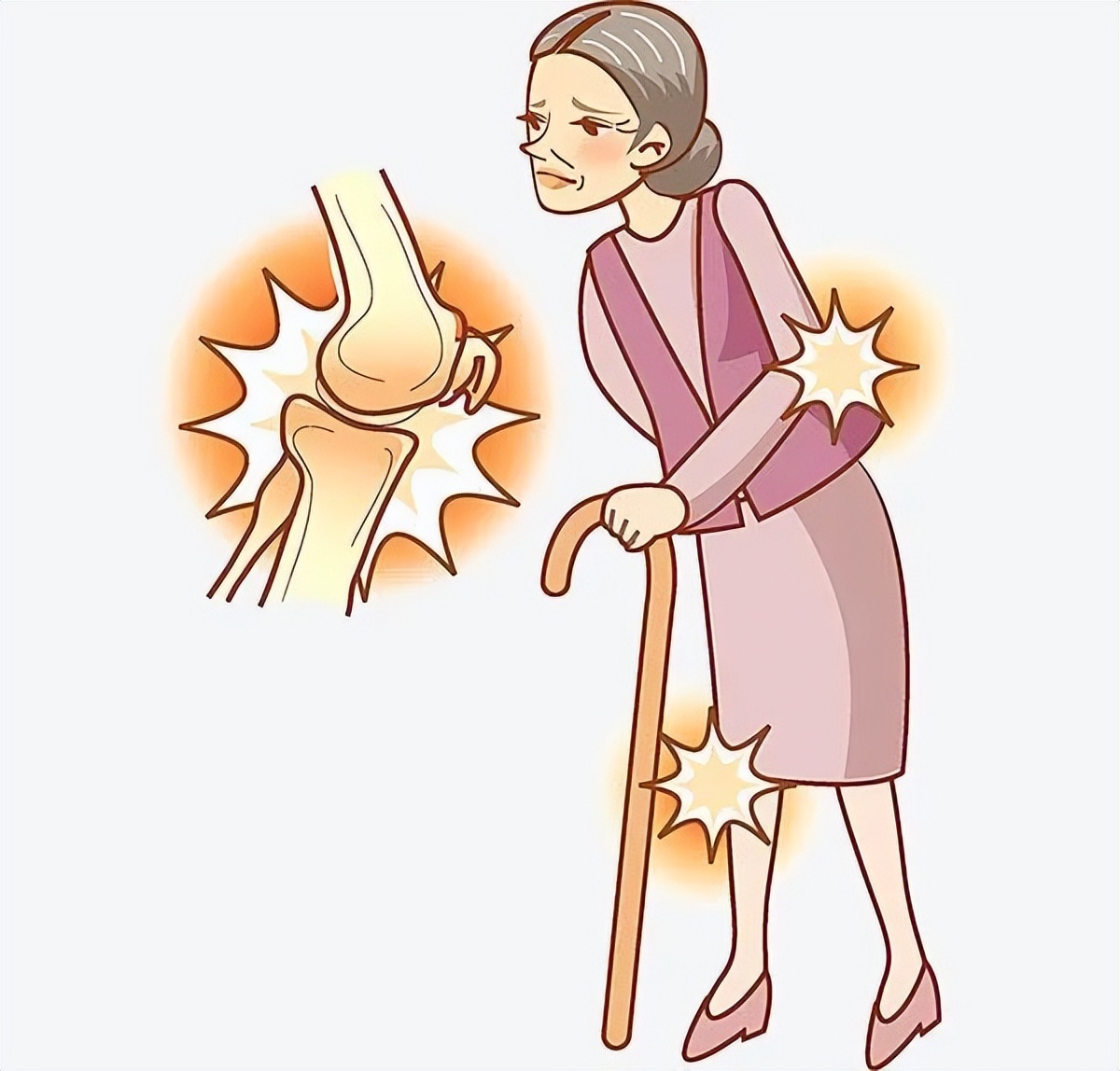 简单骨性关节炎自测十问,原发性骨关节炎疾病特点有哪些