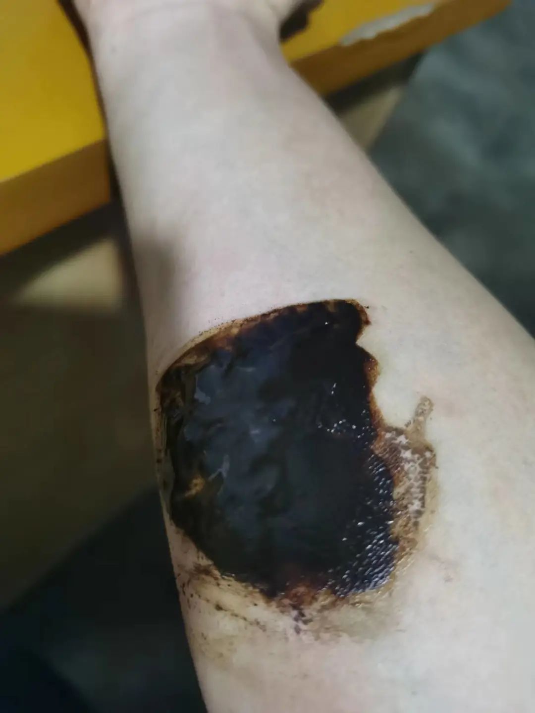 “别动！你手上有条大蜈蚣！”