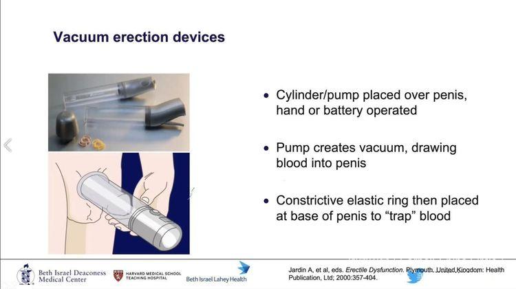 勃起功能障碍---别忽略了是糖尿病惹的祸怎么办..