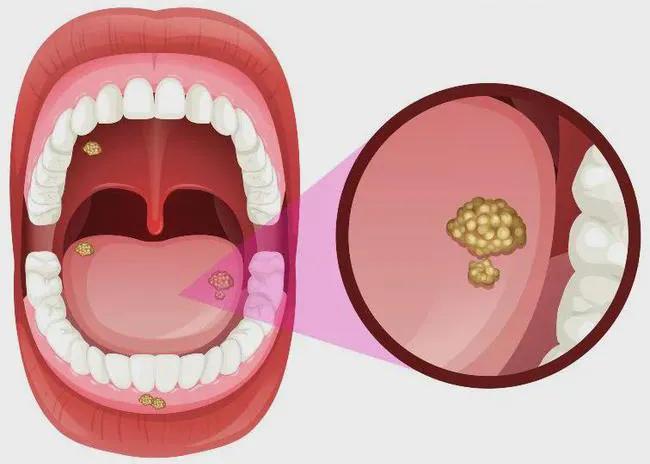 疫情期间牙齿出现问题怎么办,疫情期间牙松动疼痛怎么办