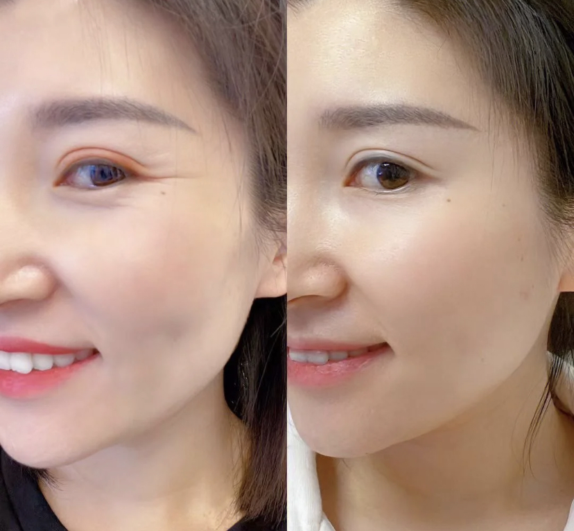 真实宝藏护肤品推荐,40-50岁高端护肤品推荐