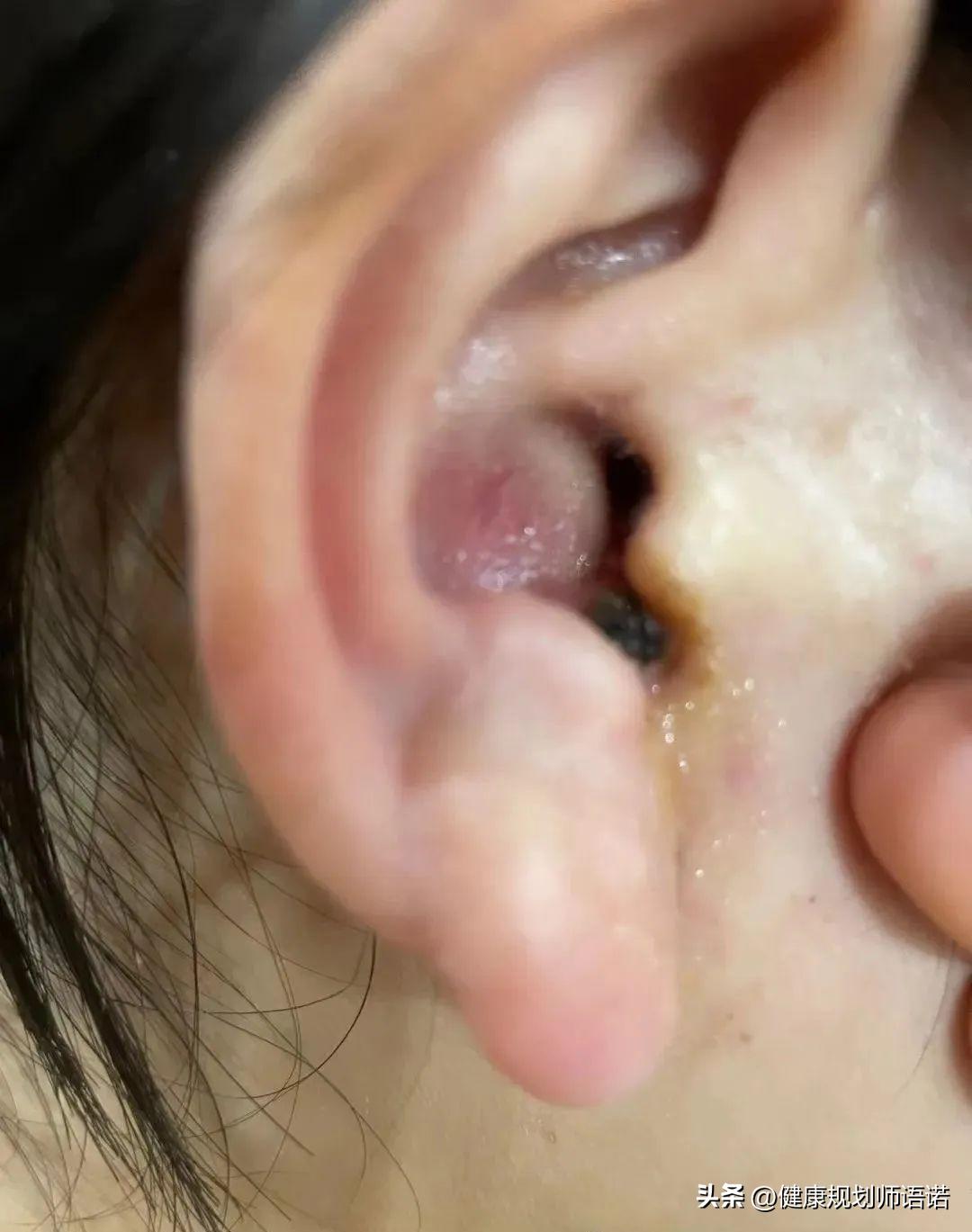 因宫颈问题走进阳光森林，用营养拯救了整个家族的健康