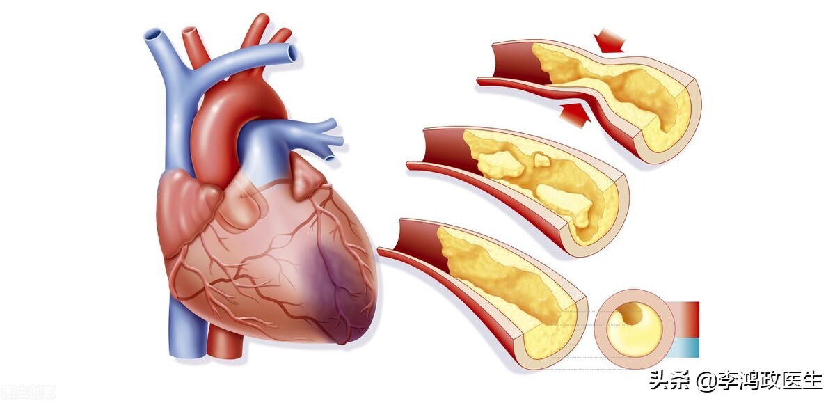 男性腰背疼痛有什么好办法,男子腰疼痛怎样治
