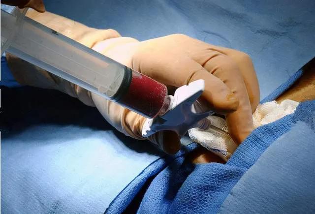 脐带血小知识,不要再被割韭菜了小红书