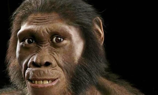 女生因为多毛症被歧视,身患多毛症