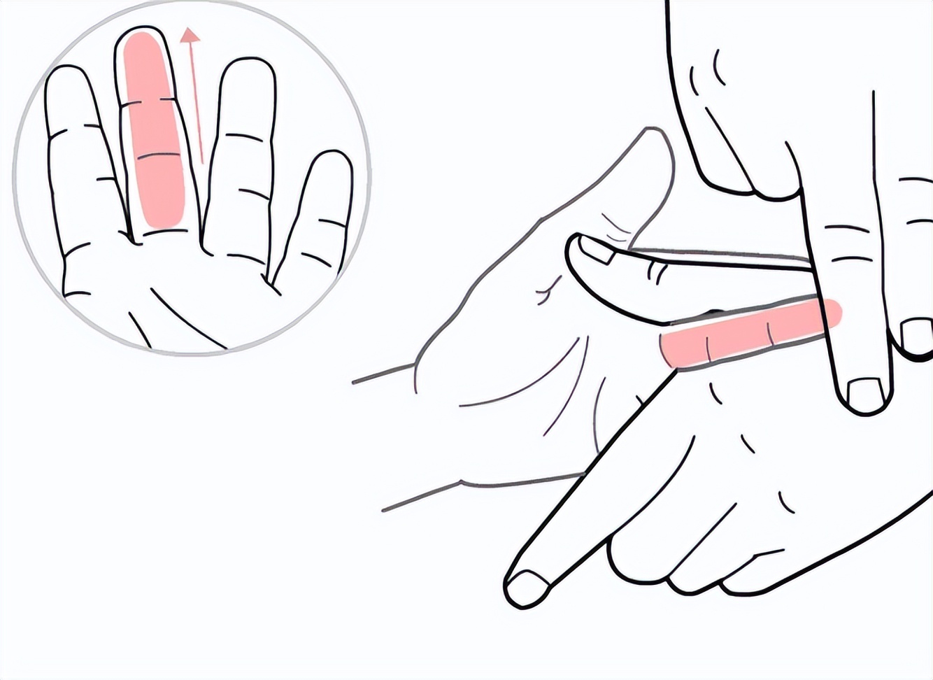 小儿夜啼推拿手法教学视频,食积引起的夜啼小儿推拿手法
