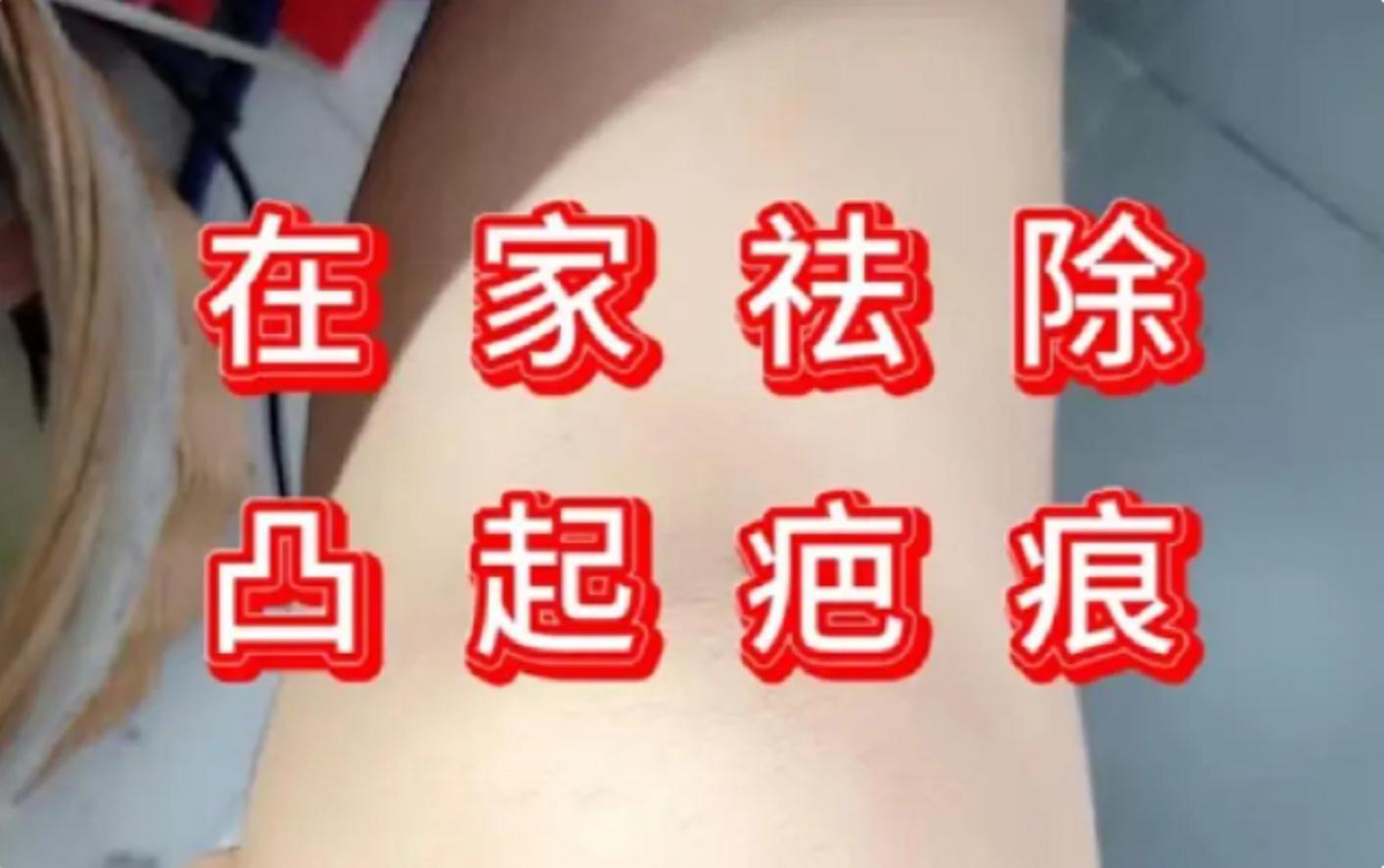 国货护肤界扛把子祛疤产品,国货祛疤产品排行榜10强