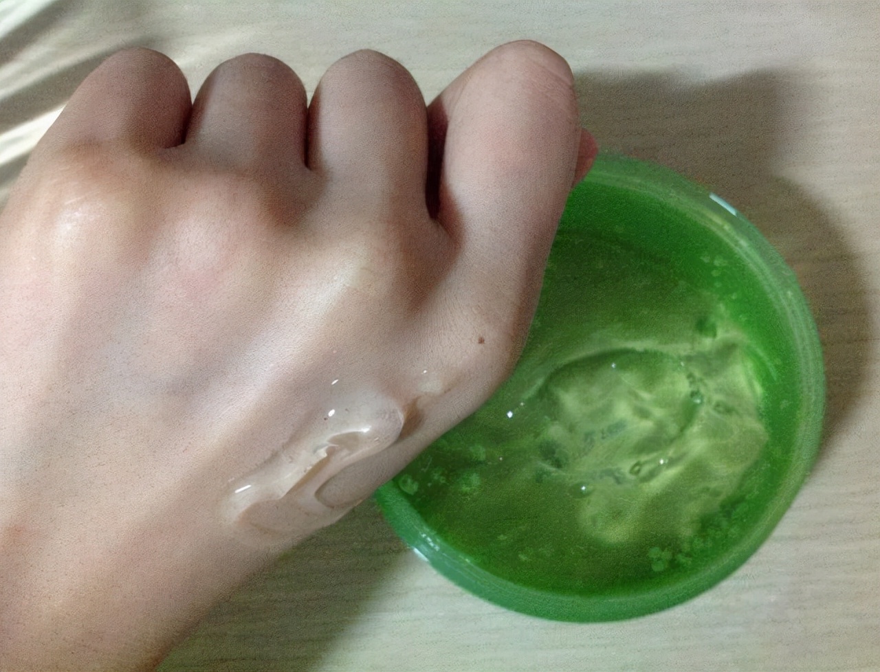 白癜风患者能在白斑上涂芦荟胶吗,白癜风光疗后结皮了能擦掉吗