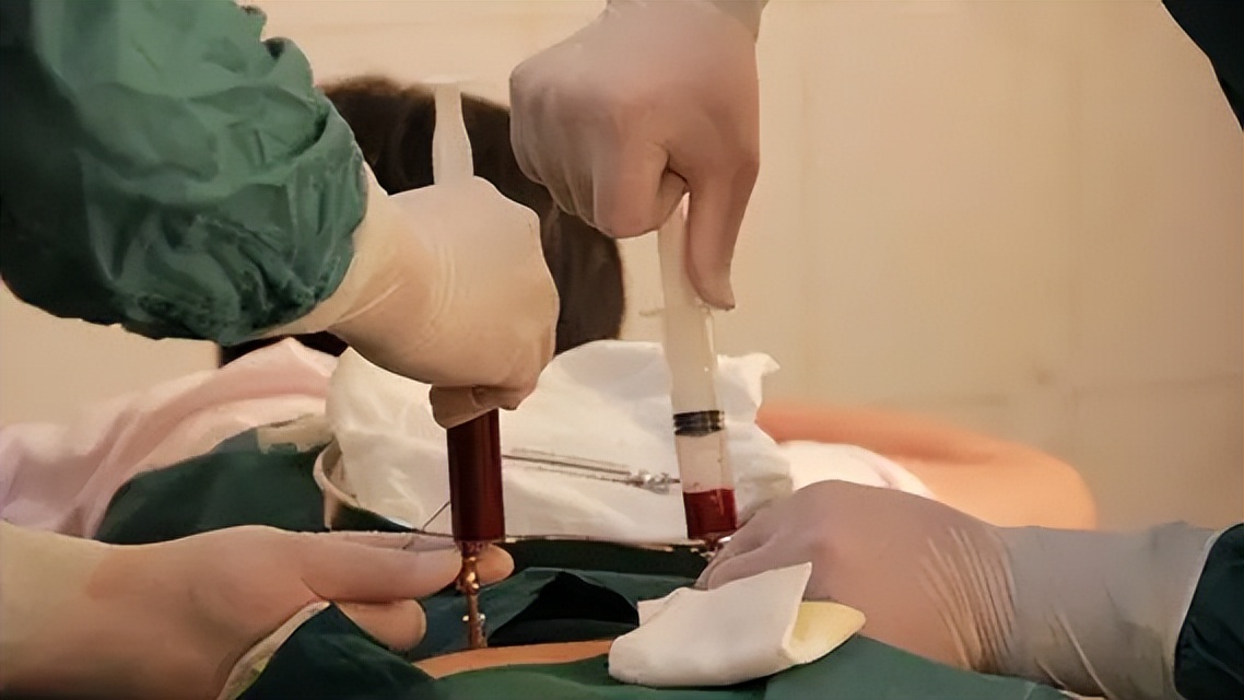 3岁女童高烧不退视频,儿童持续发烧40度左右不退怎么办