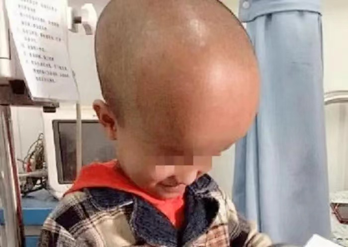 三鹿奶粉事件婴儿现况,三鹿奶粉事件结果