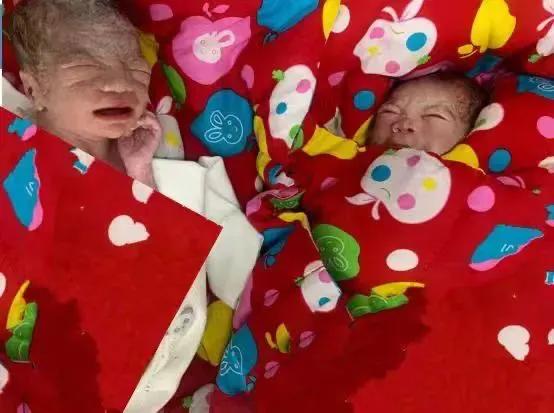 湖北省妇幼产科团队,湖北省妇幼保健院四维双胞胎