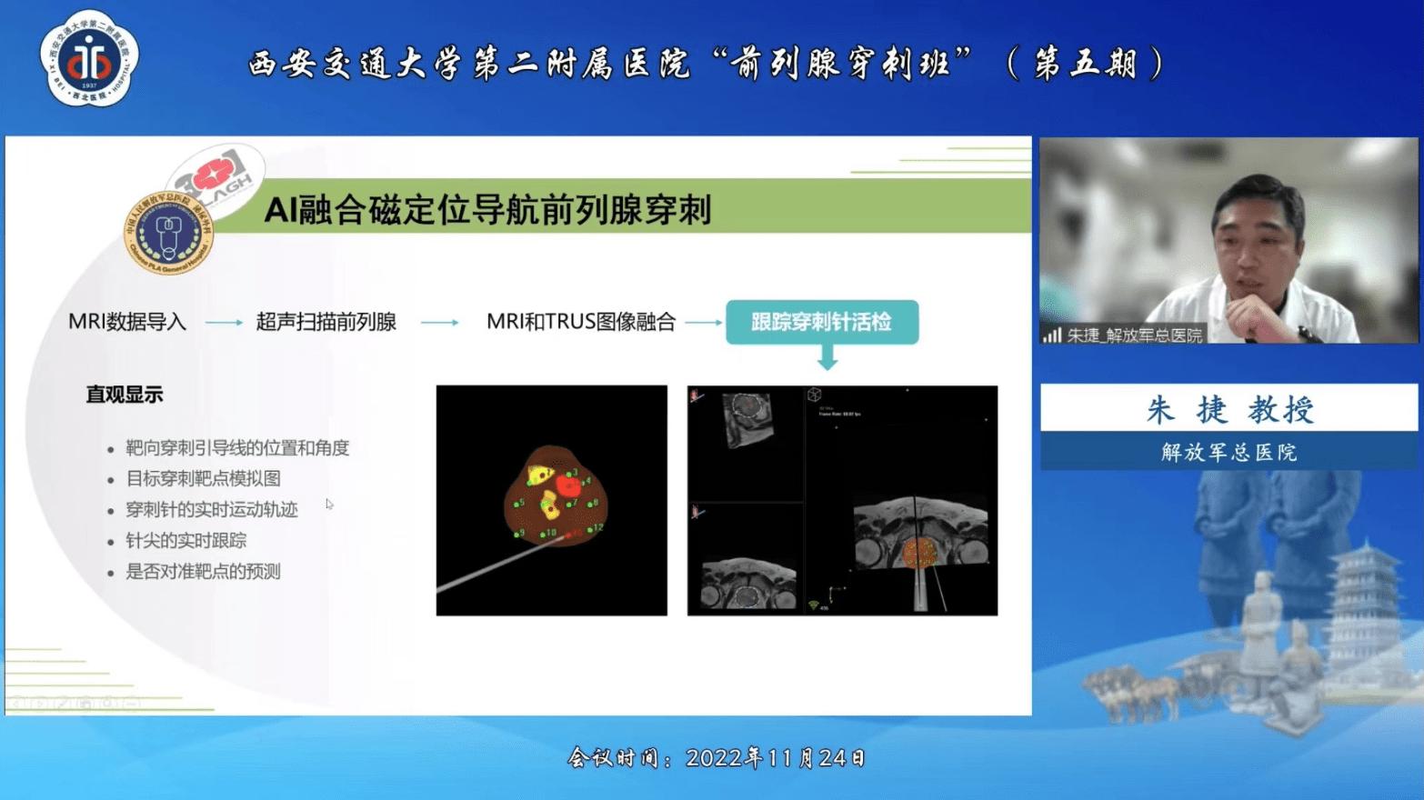 新技术赋能西安交通大学第二附属医院前列腺精准靶向穿刺新突破