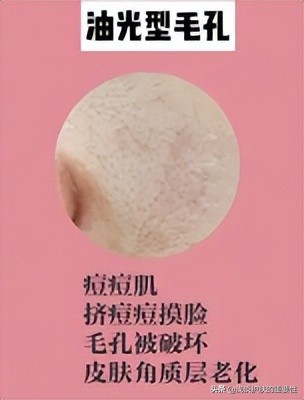 脸上的毛孔粗大用什么护肤品好,脸部毛孔粗大用什么护肤品比较好