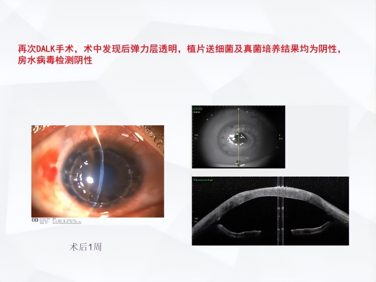 邓志宏几号坐诊,湘雅附三眼科邓志宏简历