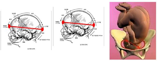 孕妈妈怎么判断胎位是正的,胎儿屁股在右侧是什么胎位