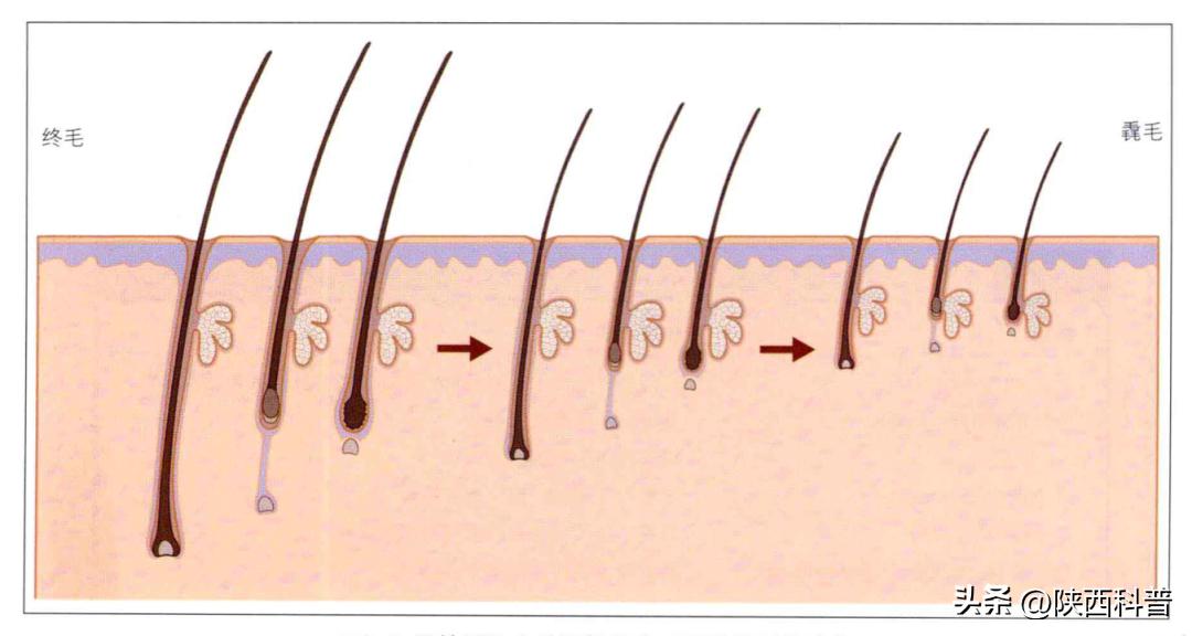 腋毛脱毛好还是刮掉好,腋毛永久去除会不会影响腋下排汗
