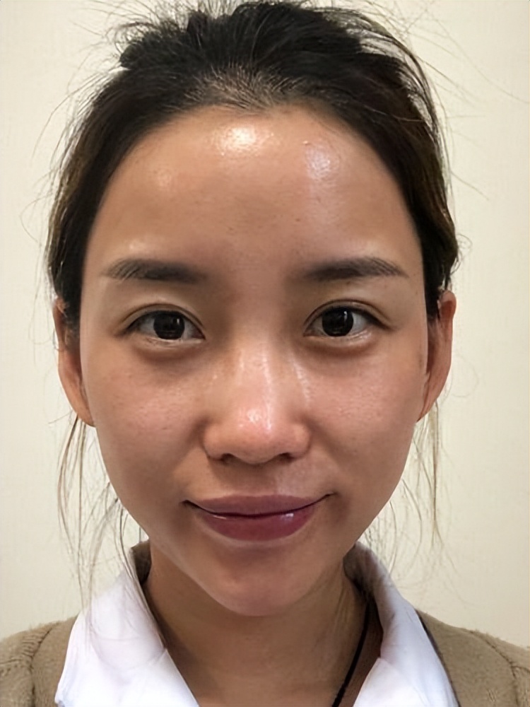 涂抹精华液真的有用吗,涂精华为什么要避开眼周