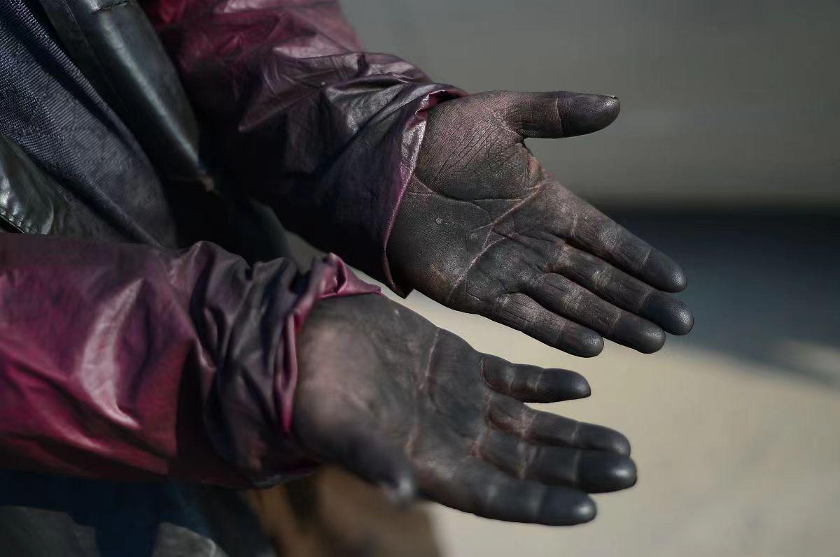 皮肤经常接触白灰,皮肤黑垢感觉洗不干净