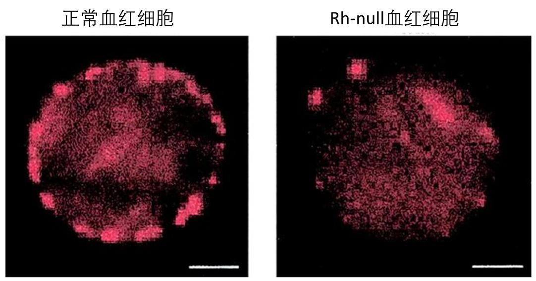 熊猫血稀有血型排行榜,比熊猫血还稀有的血型
