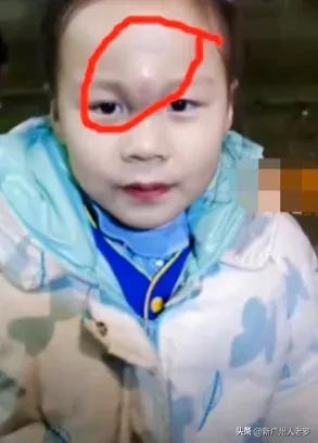 安徽拜年磕头磕哭,小女孩磕头拜年把头上磕了个包