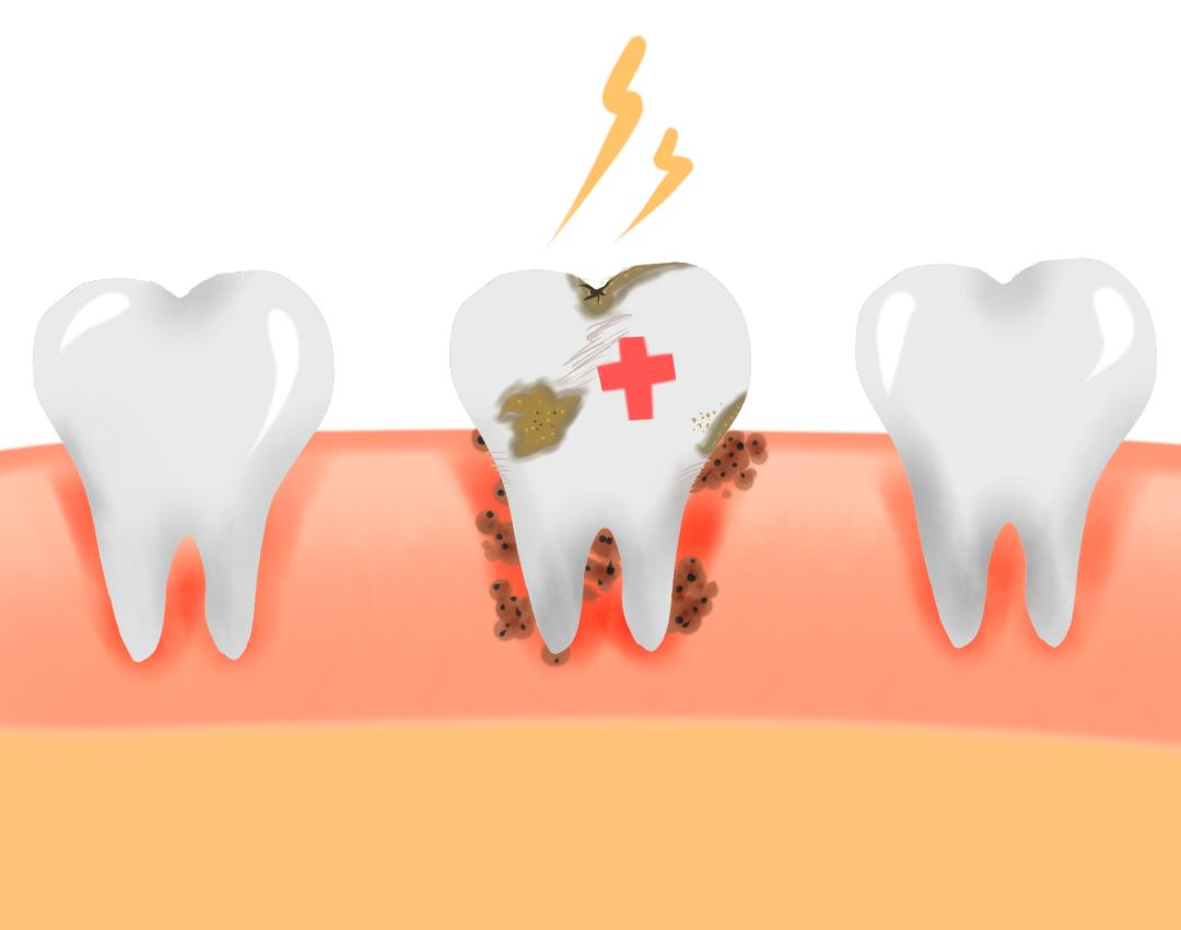 健康牙齿会晃动吗,健康牙齿松动怎么办