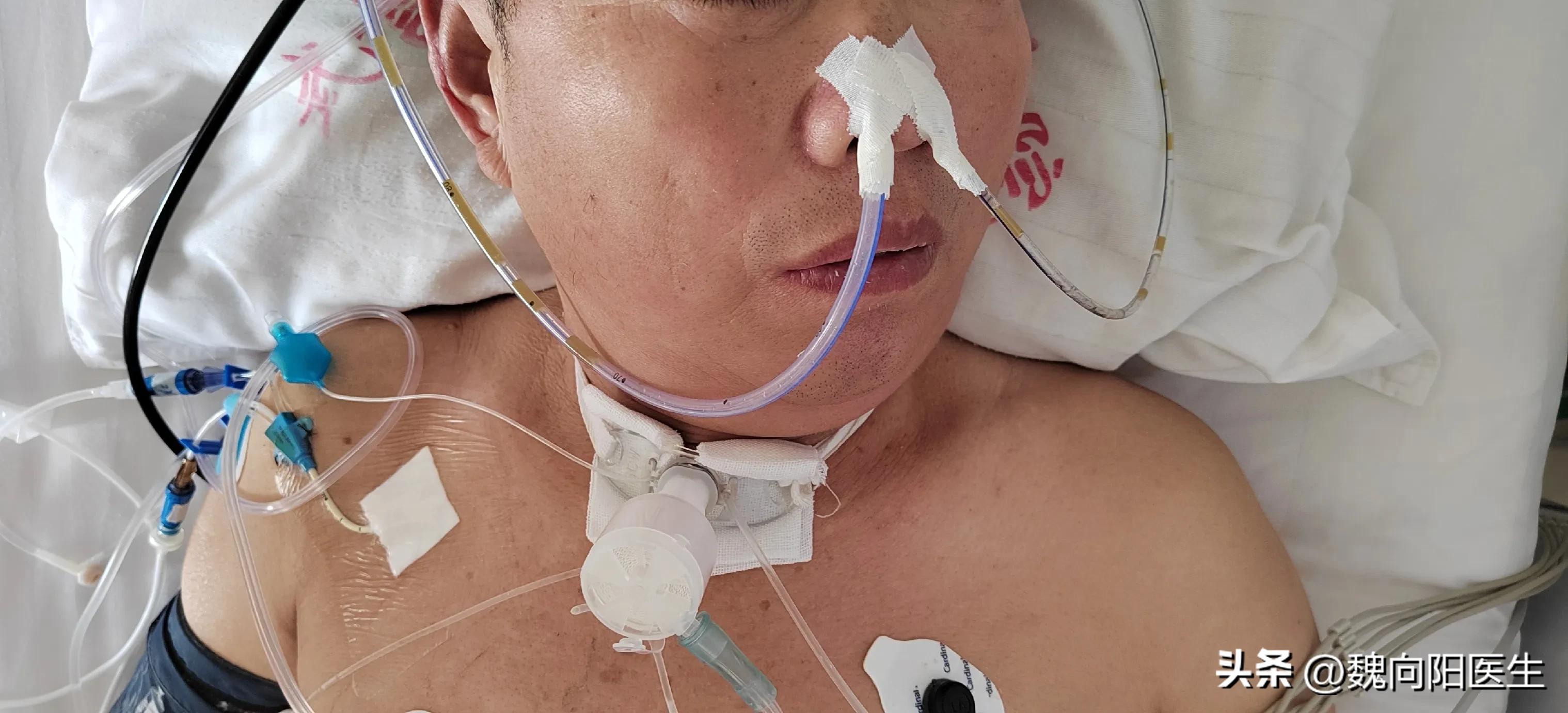 我的老父亲中风病危,我的父亲得了脑梗十九年