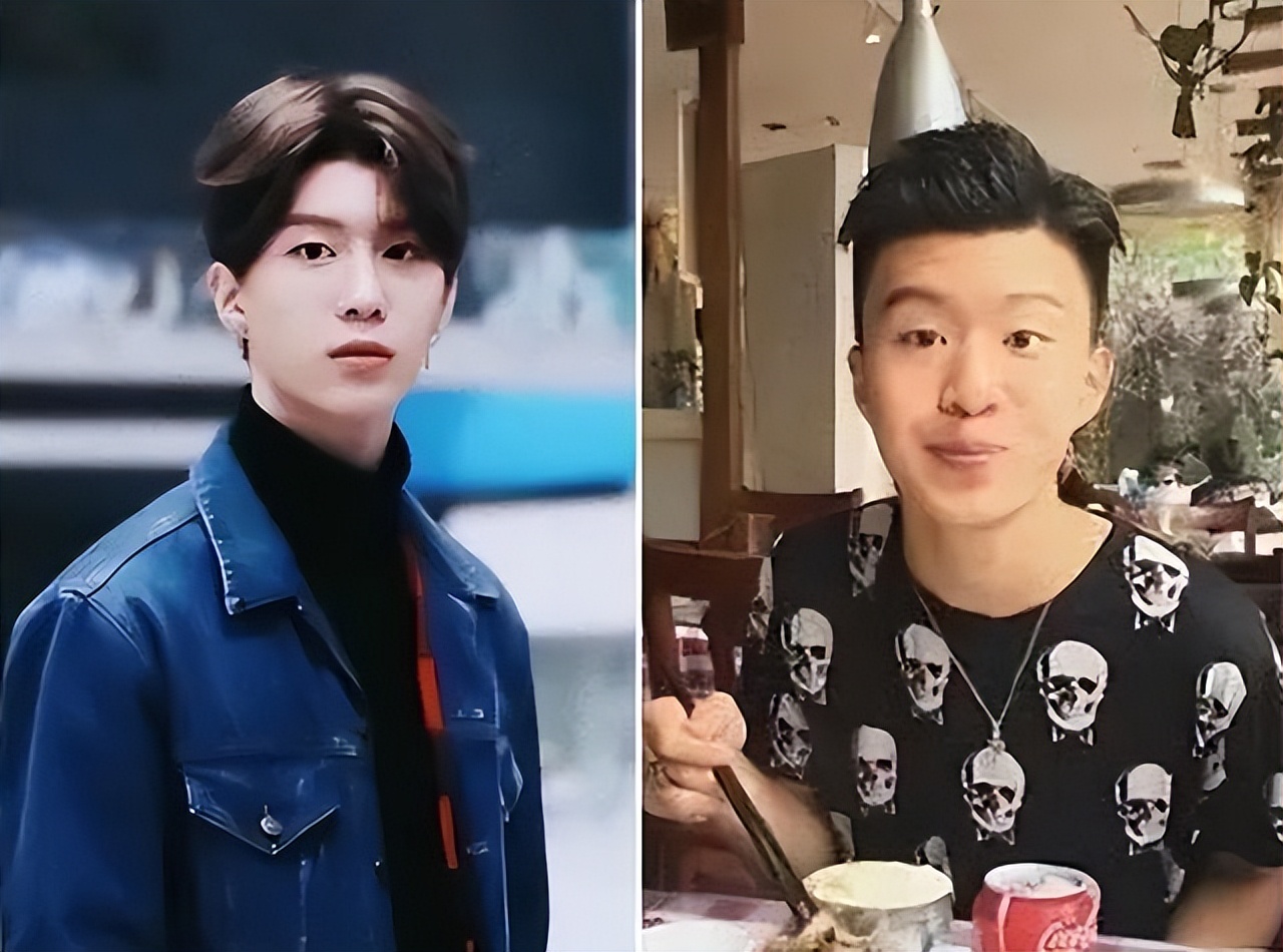 明星整容网红整容,明星整容失败后惨不忍睹的对比