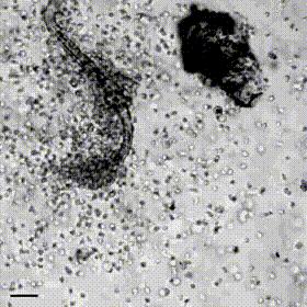 寄生虫为什么很难杀死,寄生虫为什么那么强