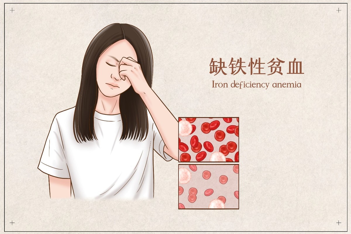 缺铁性贫血怎么补最快,缺铁性贫血怎么补铁剂