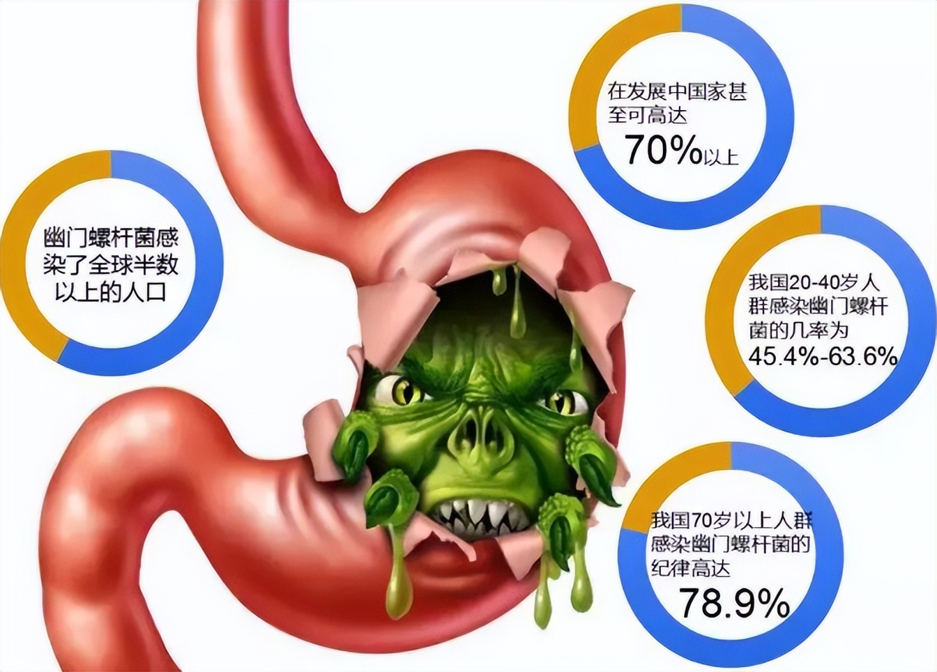 身上有怪味是大病的预兆,人如果生大病了身上会有异味