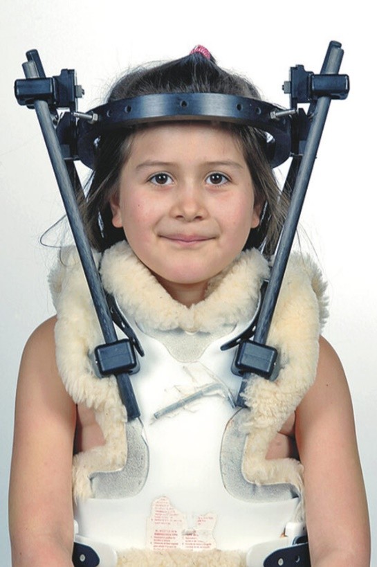 儿童落枕最快恢复办法,落枕了30秒自愈方法儿童