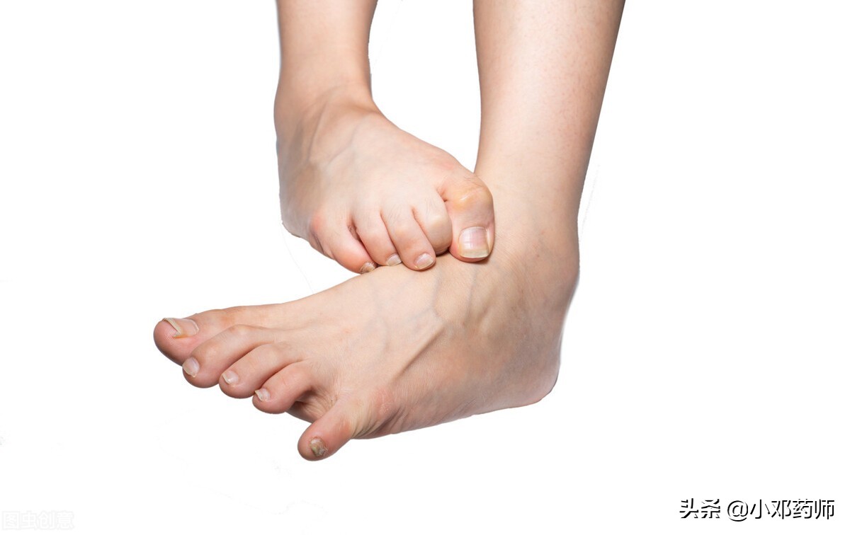 脚癣指甲特别硬怎么治,水泡型脚癣进到指甲里面怎么治疗