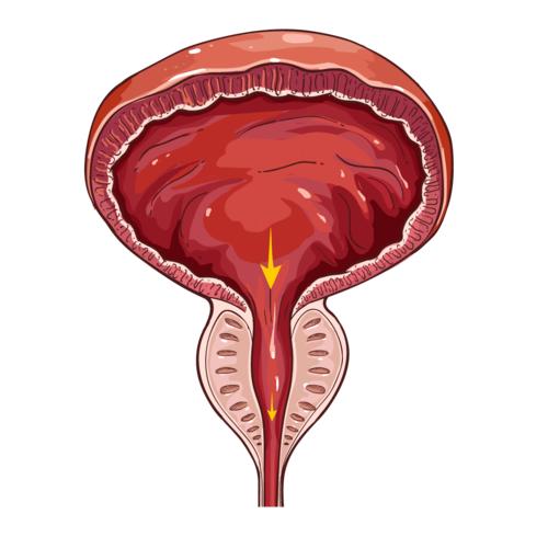 憋尿一时爽，膀胱“火葬场”！医生坦言：天再冷也不要憋尿
