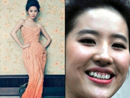 烤瓷牙的明星,烤瓷牙的明星都有谁