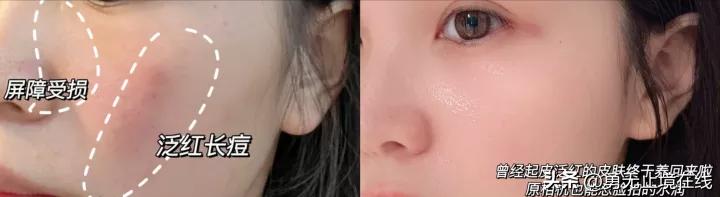 热门水乳真实测评｜避免智商税高性价比保湿美白修复水乳套装推荐