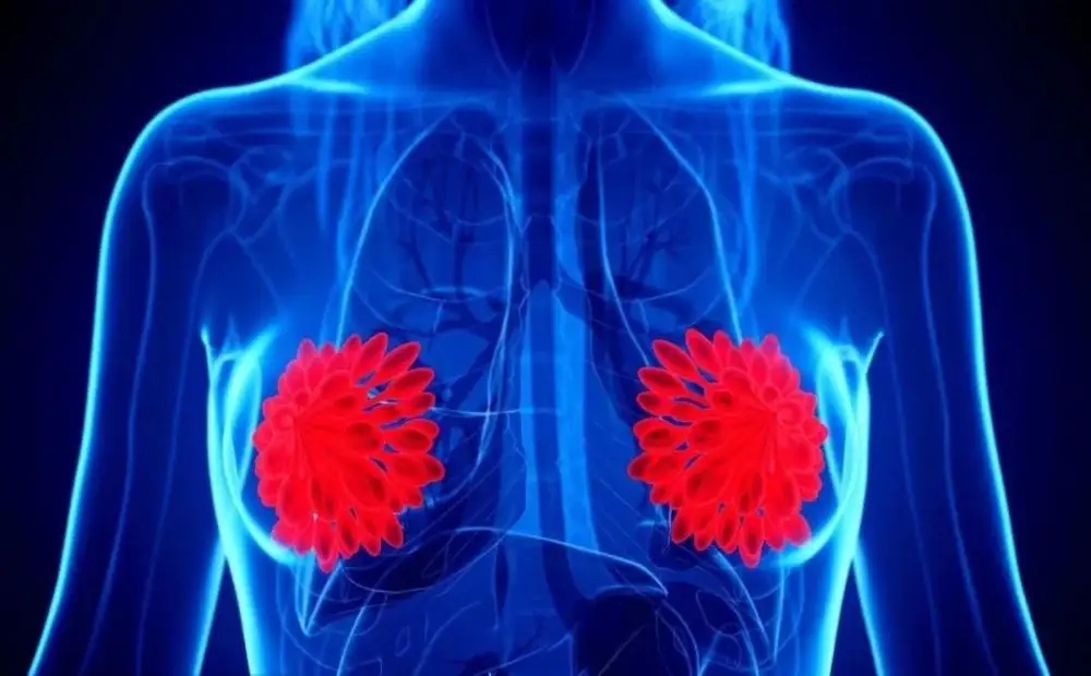 扁桃体息肉囊肿增生怎么区分,结节息肉囊肿增生的区别