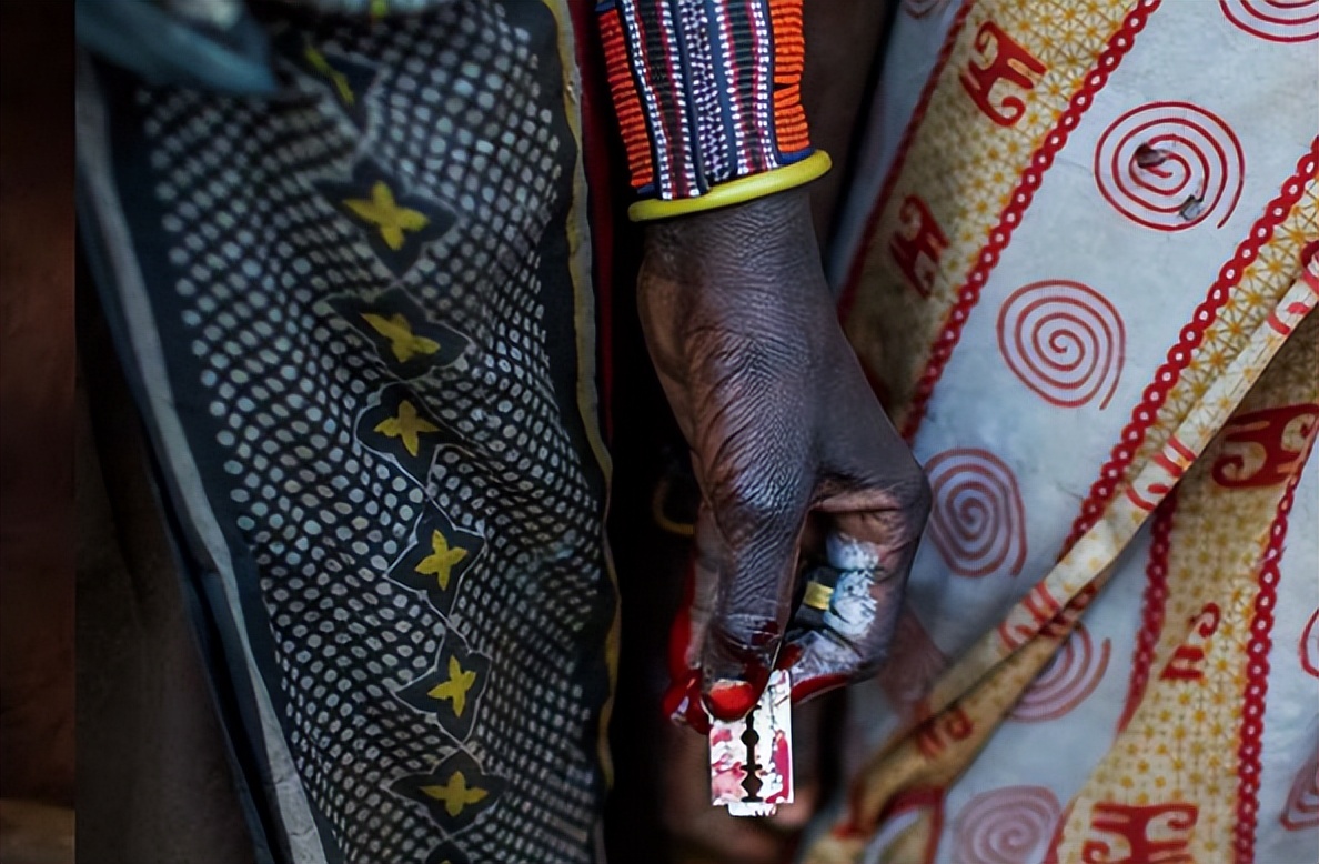 1.3亿人遭受的割礼之痛,为何现在还在继续?究竟何时才能消失?