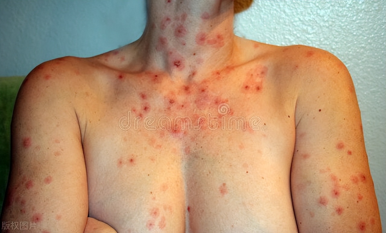 为什么有的男人会选择嫖娼？一次嫖娼会带来多少性病？可长点心吧