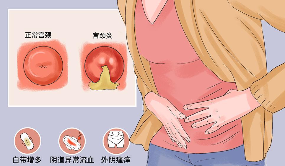 女性*处私**毛发可以剃掉？*处私**毛发的这3种用处，你需要了解