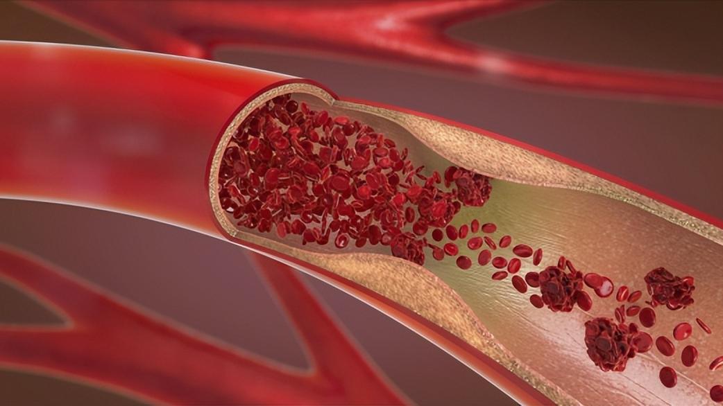 65岁大爷每天一勺三七粉，最后怎样了？4种后果要认清，别跟风吃