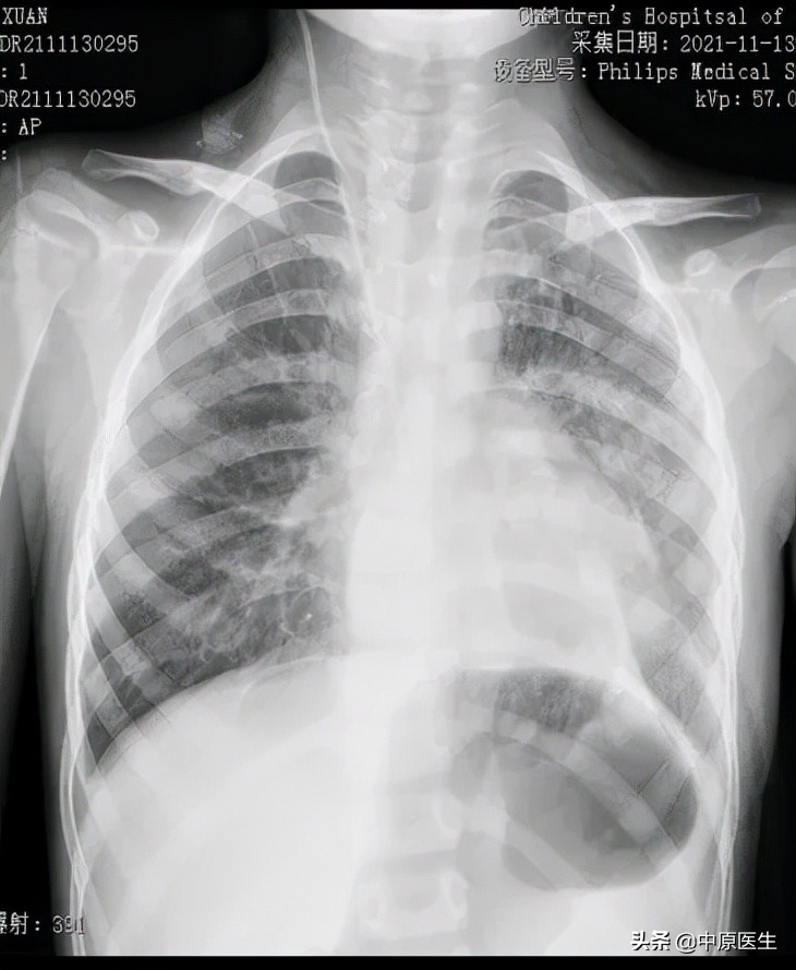 4岁孩子经常呕吐,4岁小孩吐了连续三天