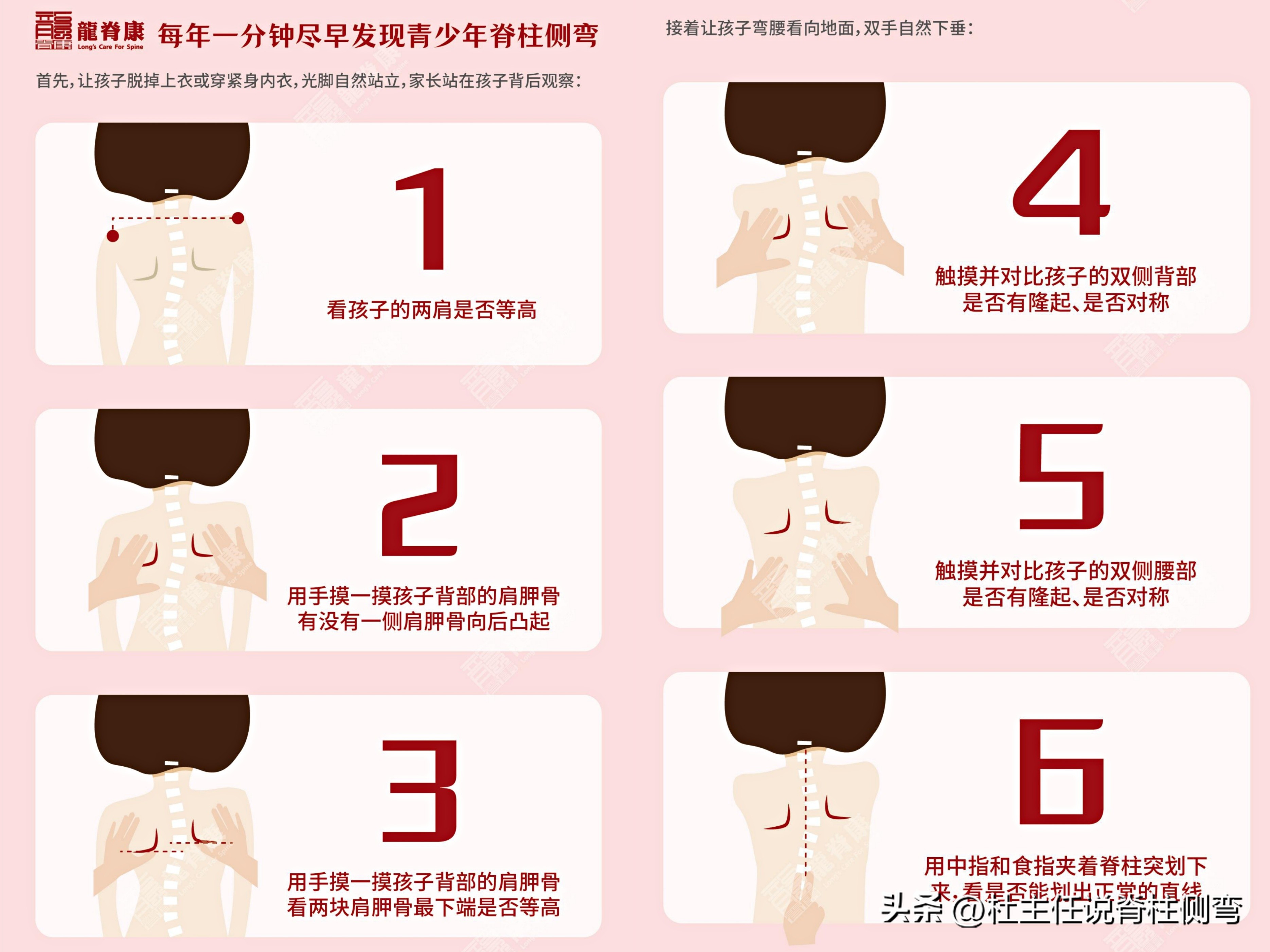 儿童侧弯10度怎么办,家长了解孩子侧弯危害性