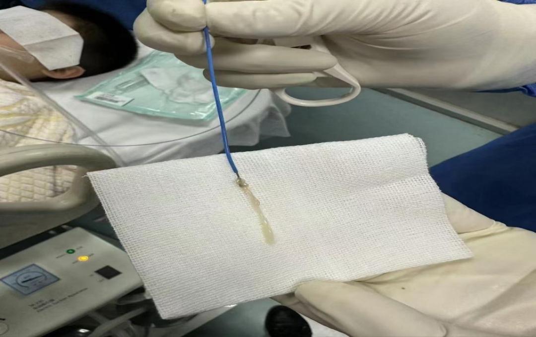 小孩咳嗽发烧前面高热后面低热,孩子反复高热咳嗽是什么原因